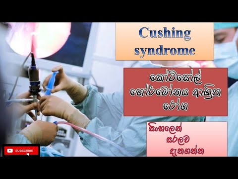 Cushing syndrome/කෝටිසෝල් හෝර්මෝනය ආශ්‍රිත රෝග/causes/how it happens/treatment/sinhala/how prevent