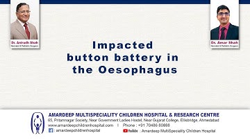 Endoscopic removal of Button battery in the Esophagus