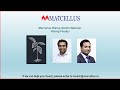 Marcellus rising giants webinar risingfinally