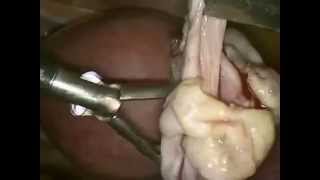 Cirurgia Reprodutiva (Antigo) - Fertilivitá Reprodução Humana