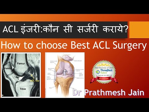 ACL Surgery Options फ़टे हुए ACL के लिए क्या क्या सर्जरी कर सकते है ? Dr Prathmesh Jain Ahmedabad