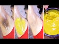 10 shades body brightening challenge  lighten your dark body parts