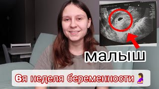 6 я Неделя Беременности 🤰| Первое УЗИ 🥰| Токсикоз 🤢| Усталость😕