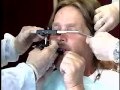 Complete denture procedure  16 face bow transfer record