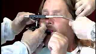 Complete Denture Procedure ; 16 Face Bow Transfer Record
