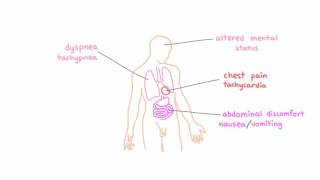 Signs and symptoms of hypoxemia