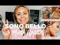 MY LASER LIPO EXPERIENCE WITH SONO BELLO PT2! [3 MONTHS POST OP!]