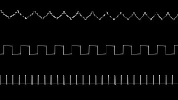 [ST Cover] coda - test1.sndh