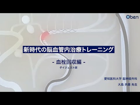 「超」入門脳血管内治療 セットアップ・血栓回収からFDまで会話形式で臨床のリア… Amazon.co.jp: 改訂2版 「超」入門 脳血管内治療: Dr.石井×Dr