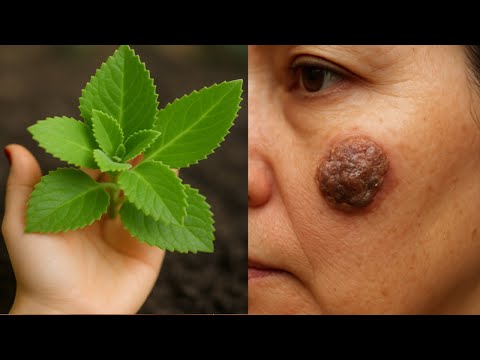 A FOLHA MEDICINAL MAIS PODEROSA❗ QUE CURA TUDO E DESINFLAMA É INACREDITÁVEL🌿 😍