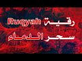 رقية سحر الدماء الشيخ ناصر زيدان الغامدي 