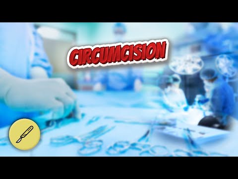 Circumcision - Everything Surgeries ✅😬⁉️