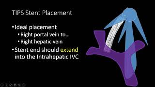 TIPS Stent US Doppler Evaluation