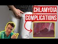 Doctor explains COMPLICATIONS of untreated CHLAMYDIA (STI) ...