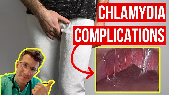 Doctor explains COMPLICATIONS of untreated CHLAMYDIA (STI) ...