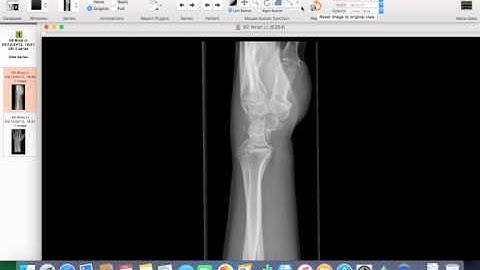 5  How to Customize Osirix Toolbar