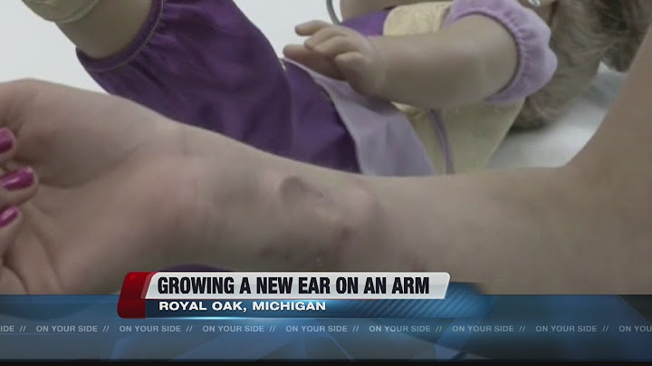 Ear growing in arm