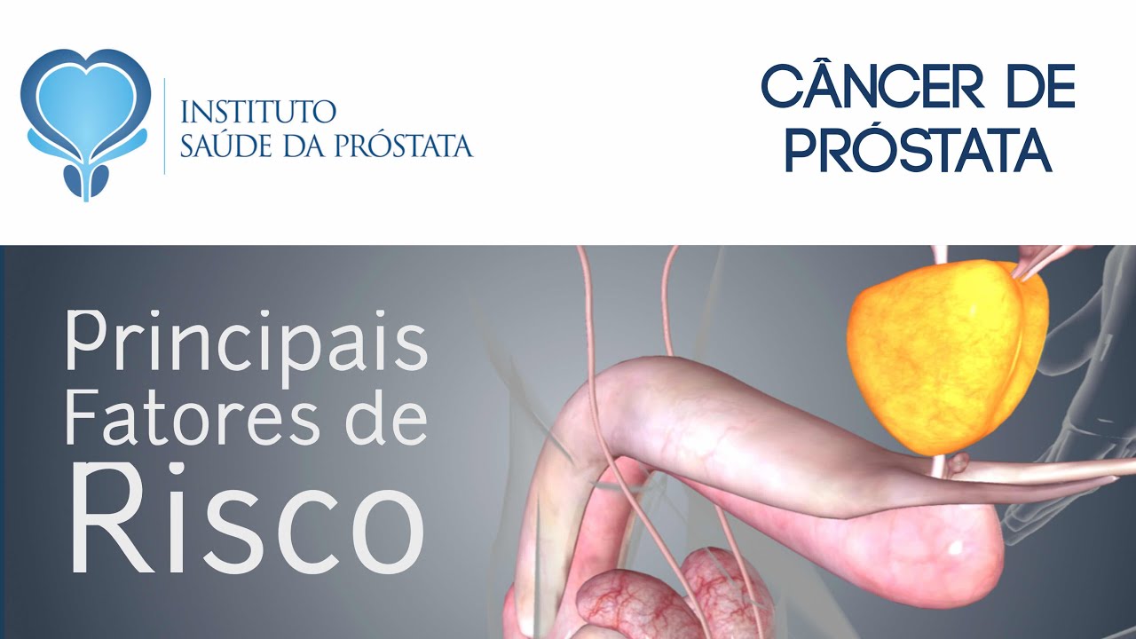 7 Quais os principais fatores de risco para o câncer de próstata? YouTube 7 Quais os principais fatores de risco para o câncer de próstata? YouTube