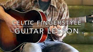 The Road To Lisdoonvarna: Guitar Lesson (Celtic Fingerstyle) chords
