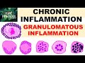 INFLAMMATION Part 9: Chronic Inflammation - GRANULOMATOUS INFLAMMATION