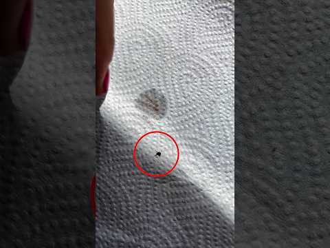 حشرة ذكية تهزم فخ رجل قبل أن تقع في مصيرها