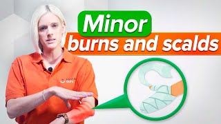 Minor Burns And Scalds  - First Aid Training Ep13 (2022)