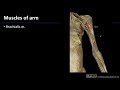 MSK Lab 2 Station 10 - Muscles of Arm