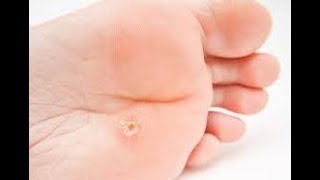 Nasira Ne İyi̇ Geli̇r İşte Cevabi