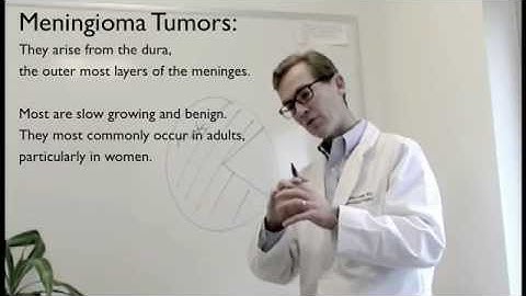 BrainCancer.org: Brain Tumor 101 "Understanding Brain Tumors"