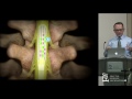 Spinal Cord Stimulation Update by Ryder Gwinn, M.D.