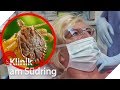 Parasit im Kopf! Tier ist durch die Nase ins Hirn gekrabbelt! | Klinik am Südring | SAT.1 TV