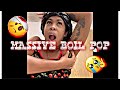 MASSIVE BOIL POP HIDRADENITIS SUPPURATIVA HYPERPIGMENTATION MASSIVE BOIL POP HIDRADENITIS SUPPURATIVA HYPERPIGMENTATION