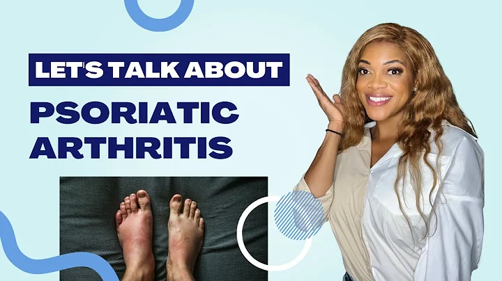 What You Need To Know About Psoriatic Arthritis #psoriasis #psoriasisawareness #psoriaticarthritis