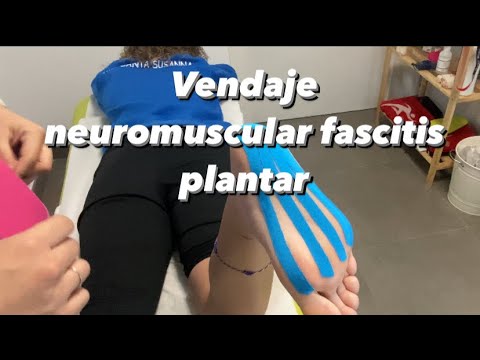 Vendaje neuromuscular fascitis plantar