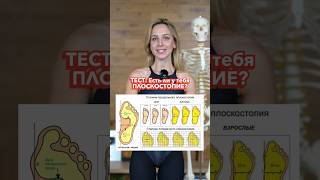 ТЕСТ: Проверь, если ли у тебя Плоскостопие?