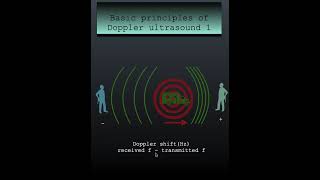 Basic principles of Doppler ultrasound 1 #echocardiography #cardiologytraining