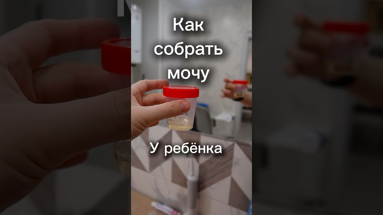 Как собрать анализ мочи у взрослого ребёнка.