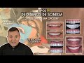 Tipos de Diseños de Sonrisa 🦷 ¿Solo tengo una opción? 🤔 - Odontología Láser.