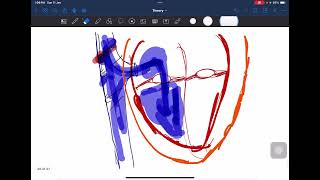 Understand What Happens To Cvp,Co,Svr In Different Types Shock In A Simplified Way