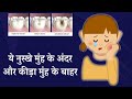 ये नुस्खे मुंह के अंदर और कीड़ा मुंह के बाहर | Danton ki cavity ko Kaise dur kare haraye gharelu upay