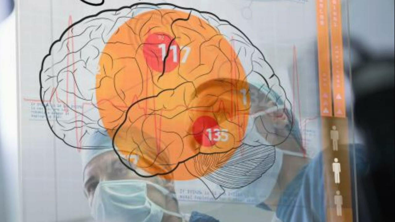 What Is The Brain Parenchyma YouTube What Is The Brain Parenchyma YouTube