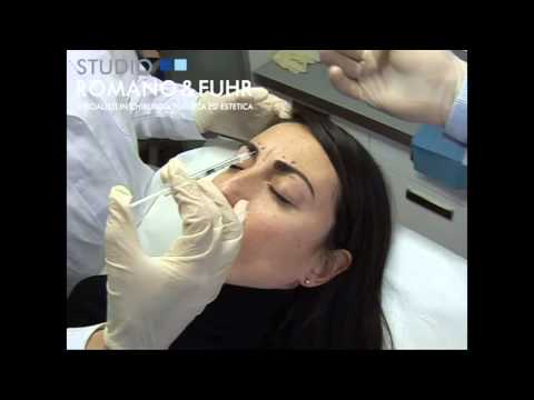 Video: Francisca Lachapel Le Inietta Botox In Faccia