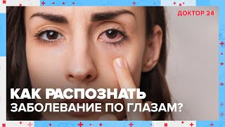 Как по ГЛАЗАМ распознать заболевания? | Доктор 24