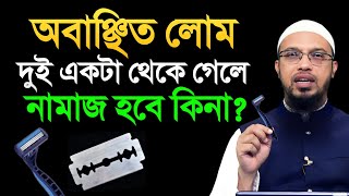 অবাঞ্ছিত লোম দুই একটা থেকে গেলে নামাজ হবে কিনা? শায়খ আহমাদুল্লাহ