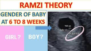 GENDER DETECTION AT 6 TO 8 WEEKS SCAN |GENDER DETECTION AT EARLIER SCAN | RAMZI THEORY |BOY OR GIRL|