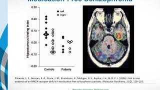 Causes of Schizophrenia. Glutamate and the Glutamate Hypothesis
