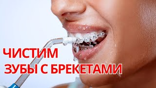 Полный алгоритм чистки зубов с брекетами: 6 шагов.