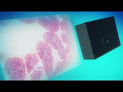 Augmentiqs - Digital Pathology in the Microscope