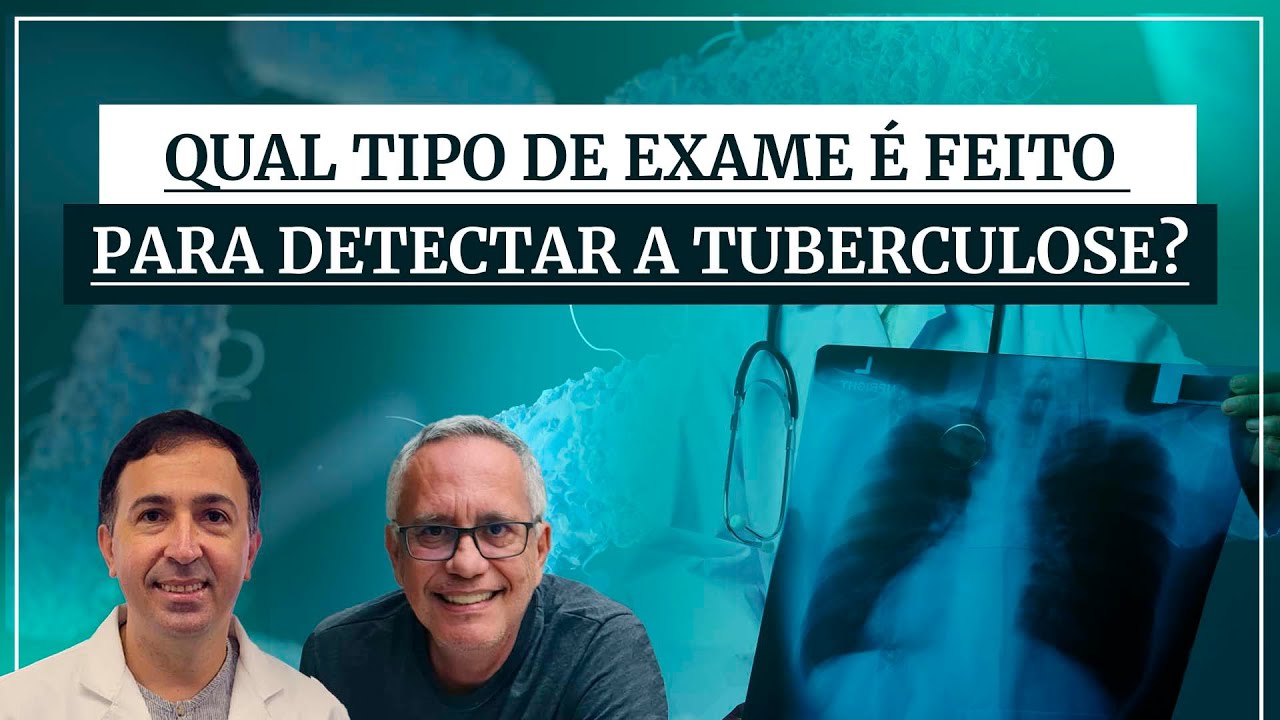 Qual tipo de exame é feito para detectar a tuberculose? | Minuto ...