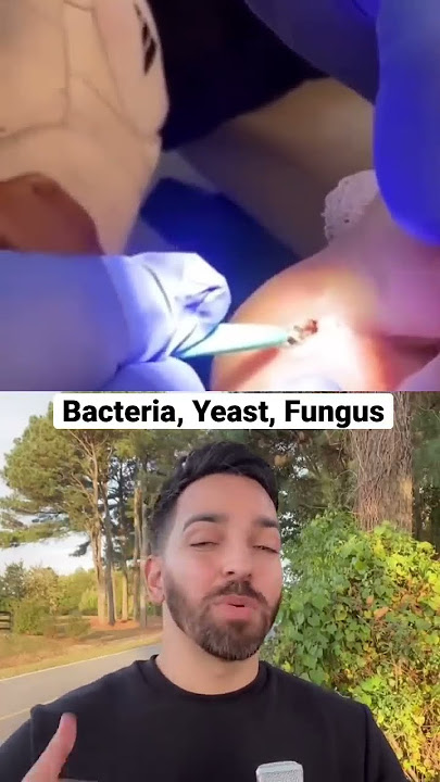 Doctor Reacts to INSANE Splinter | #shorts